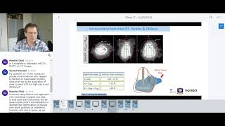 SCMPCR ELP03 Lecture 7 Brachytherapy Practical Session [upl. by Simpkins]