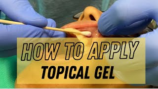 How to Apply Topical Gel on our Patient [upl. by Eldwun887]