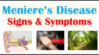 Meniere’s Disease Signs amp Symptoms amp Why They Occur [upl. by Lacym131]