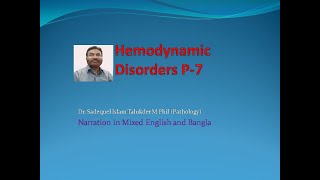 Hemodynamic Disorders Part7 Pathology Lecture by Dr Sadequel Islam Talukder [upl. by Alyakem856]