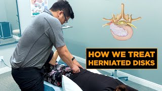 How We Treat a Herniated Disk  Physical Therapy [upl. by Nam506]