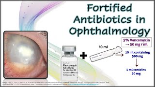 Fortified Antibiotics in Ophthalmology [upl. by Sension272]