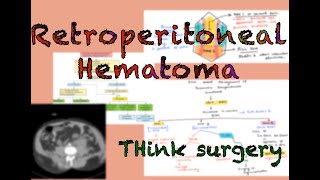 Retroperitoneal Hematoma and Management [upl. by Enidualc]