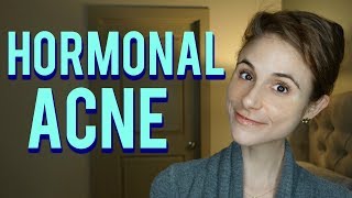 Hormonal acne Dr Dray QampA [upl. by Elitnahc]