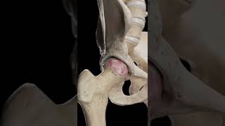 🦴 Hip Arthrosis When the Hip Joint Wears Down anatomy [upl. by Sille]