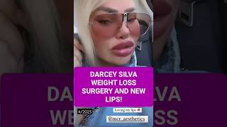 Darcey Silva gets weight loss surgery and new lips after getting the old lips dissolved 90dayfiance [upl. by Etoile131]