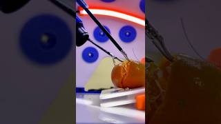 How laparoscopic surgery are done shortsvideo [upl. by Posehn840]