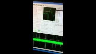 Electrophysiological Recording Example [upl. by Nnayecats]