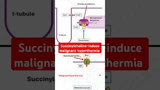 Succinylcholineinduce malignant hyperthermia [upl. by Jaynell]