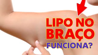 LIPO HD NO BRAÇO FUNCIONA [upl. by Vitalis970]