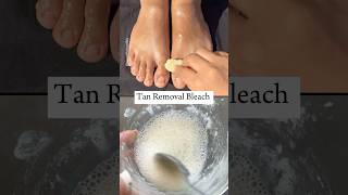 Feet Tan Removal Bleach Instant Results in 2 Minute 😱feetwhitening padicure diy beauty [upl. by Neila591]