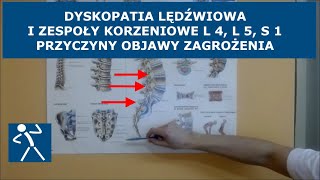 Dyskopatia lędźwiowa  Przepuklina  Zespół korzeniowy L4 L5 S1  Ból brak czucia niedowład I 🇵🇱 🇪🇺 [upl. by Neeluqcaj]