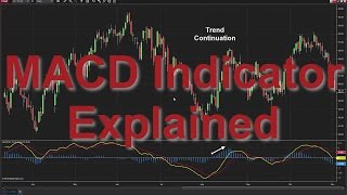 How to Use the MACD Indicator Moving Average Convergence Divergence [upl. by Beutler]