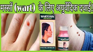 Wart remover lotion  मस्सों के लिए अयुर्वेदिक दवाई  Wartosin wart remover Ayurvedic lotion [upl. by Giustina271]