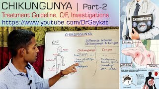 Chikungunya  Part 2  Treatment Guideline with Clinical features amp Investigations  Dr Saykat [upl. by Safier45]