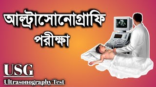 আলট্রাসনোগ্রাম পরীক্ষা । ইউ এস জি USG টেস্ট । Ultrasound test in bangla [upl. by Dickey]