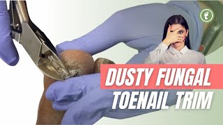 DUSTY FUNGUS ✂️ TOENAIL TRIM [upl. by Tremann962]