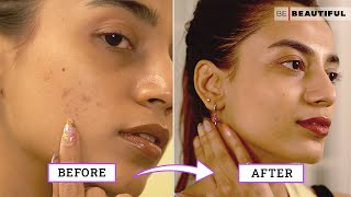 How To Improve Your Skin Texture  Skincare Tips For Bumpy Skin  Be Beautiful [upl. by Leatri]