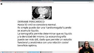 CARDIOMEGALIA E INSUFICIENCIA CARDIACA [upl. by Pol]