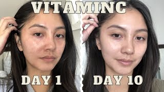 adding VITAMIN C serum to my skincare routine for 10 days  Vichy LiftActiv before amp after [upl. by Erimahs301]