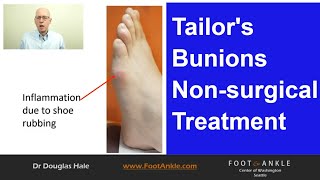 Tailors Bunion Best Practices  Seattle Podiatrist [upl. by Otsirc]