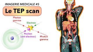 IMAGERIE MEDICALE 5  Le TEP scan [upl. by Nivej]