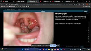 Otolaryngology ENT Sore Throat [upl. by Ynabla]