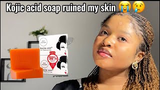 Stop using kojie San soapkojie San soap review kojic acid soapkojie San skin lightening soap [upl. by Aihsined511]