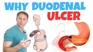 Understanding a Duodenal Ulcer [upl. by Ignatius]