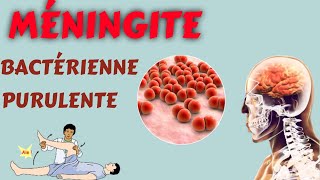 Méningite bactérienne purulente [upl. by Hniht403]