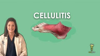 Cellulitis [upl. by Ardnuassac]