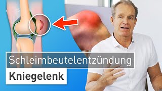 Knie angeschwollen und gerötet Das hilft bei Schleimbeutelentzündung am Knie  Dr Stefan Preis [upl. by Yregram474]