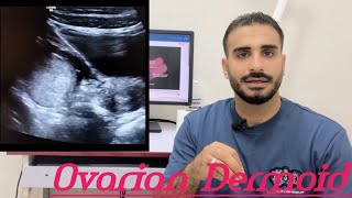 Level 3  Female pelvis  Gyn  Ovary  Ovarian dermoid cyst [upl. by Gravante]