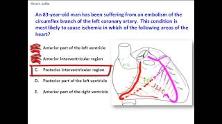 Distribution of the circumflex branch of left coronary artery [upl. by Kcarb]