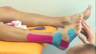 Kinesiology taping  Tejping kotníku oboustranně  varianta II [upl. by Assile]