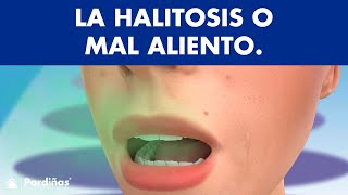 Mal aliento o Halitosis  ¿Qué la causa y cómo se cura © [upl. by Madeleine475]