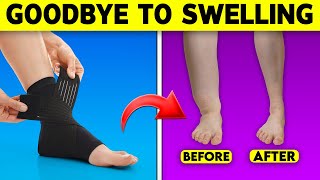 Defeat Lymphoedema How To Control Swollen Legs And Feet [upl. by Assetal]