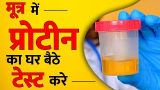 Home Test for Protein in Urine  यूरिन प्रोटीन टेस्ट घर पर कैसे करे [upl. by Etnasa]