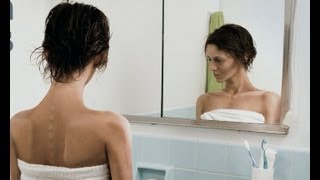 La anorexia nerviosa la bulimia y la importancia de atenderlas a tiempo [upl. by Eahs]