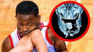 Most DANGEROUS Injuries in NBA [upl. by Enidlarej]