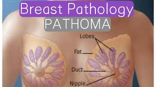 Breast Pathology PATHOMA 2  Benign Conditions  Risk Factors of Breast Cancer [upl. by Edward646]