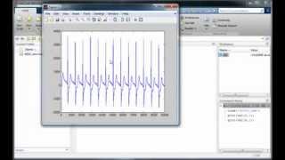 Video1ECG Signal Where could you find and how can load that in MATLAB [upl. by Nitaf]