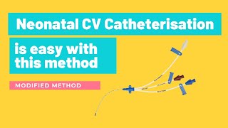 A new method of Central Venous Catheter insertion to a neonate by DR Kapila Hettiarachchi [upl. by Tabshey805]