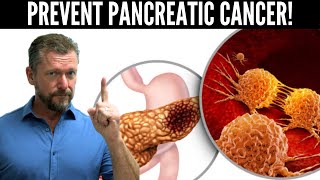 Lower Pancreatic Cancer Risk Pancreas Cancer Risk Test [upl. by Nnairet365]