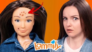 Doll with ACNE and Cellulite Lammily Doll Review [upl. by Hines]