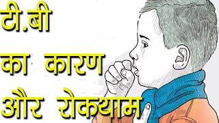 टीबी का कारण और रोकथाम  TB ka desi ilaaz  Tips for Tuberculosis Patient  Ayurvedic Samadhan [upl. by Brawley]