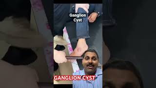 Ganglion cyst [upl. by Arimaj]