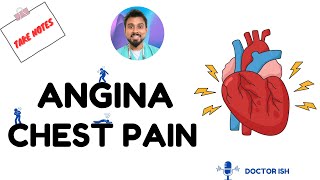 Understanding Stable Angina Causes Symptoms and Treatment  Doctor ish  MBBS’ DRHGMC UK🇬🇧 [upl. by Sorac994]