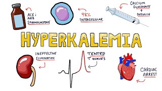 An Approach to Hyperkalemia  ECG changes in Hyperkalemia  What are the causes of Hyperkalemia [upl. by Octavius]