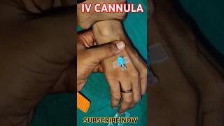 IV CANNULA INSERTION 🩺💉🩺💉🩺💉💉💉💉💉🩺💉cannula youtubeshorts shortshospital viral medicarenurshing [upl. by Ayokahs]